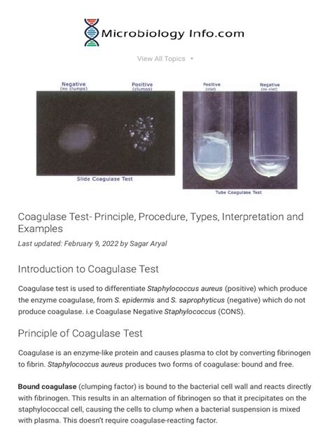 coagulase test results|Coagulase Test : Types, Principle, Procedure, Interpretation and Exampl.